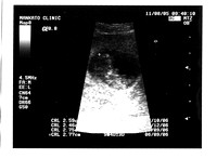 11-8-2005 Calvin ultrasound